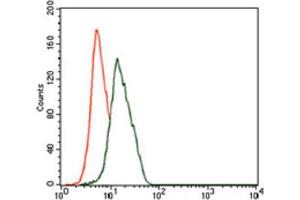 Immunohistochemical analysis of paraffin-embedded liver cancer tissues using ENO2 antibody with DAB staining. (ENO2/NSE 抗体  (AA 251-433))