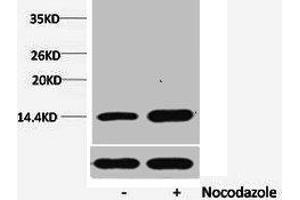 Western blot analysis of extracts from Hela cells, untreated (-) or treated, 1:5000. (HIST1H1A/HIST1H1C/HIST1H1D/HIST1H1E (pSer1) 抗体)