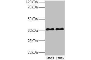 Western blot All lanes: SUPT3H antibody at 2 μg/mL Lane 1: Mouse brain tissue Lane 2: Colo320 whole cell lysate Secondary Goat polyclonal to rabbit IgG at 1/10000 dilution Predicted band size: 36, 38 kDa Observed band size: 36 kDa (SUPT3H/SPT3 抗体  (AA 1-328))