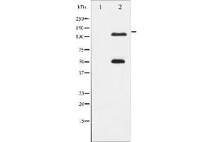 Western blot analysis of NF- kappaB p105/p50 phosphorylation expression in MDA-MB-435 whole cell lysates,The lane on the left is treated with the antigen-specific peptide. (NFKB1 抗体  (pSer337))