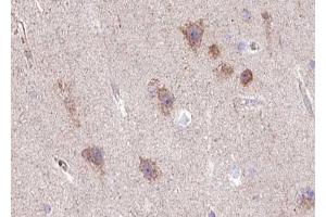 ABIN6267516 at 1/100 staining human brain tissue sections by IHC-P. (GRIA2 抗体  (pSer880))