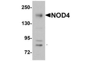 Western blot analysis of NOD4 in EL4 cell lysate with NOD4 antibody at 1 μg/ml. (NLRC5 抗体  (N-Term))