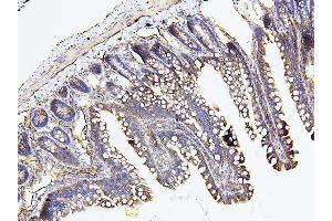 IHC analysis of NF2 using anti-NF2 antibody (ABIN7600115).