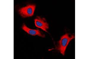 Immunofluorescent analysis of MMP13 staining in HeLa cells. (MMP13 抗体  (N-Term))