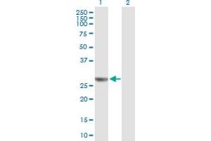 Western Blot analysis of NUDCD3 expression in transfected 293T cell line by NUDCD3 MaxPab polyclonal antibody. (NUDCD3 抗体  (AA 1-220))