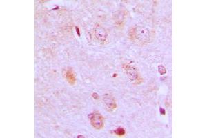 Immunohistochemical analysis of IARS2 staining in human brain formalin fixed paraffin embedded tissue section. (IARS2 抗体  (N-Term))