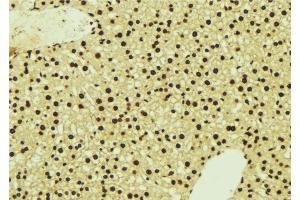ABIN6277124 at 1/100 staining Mouse liver tissue by IHC-P. (NDRG1 抗体  (C-Term))