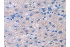 Immunohistochemistry (IHC) image for anti-Permeability Glycoprotein (AA 394-672) antibody (ABIN7433945)