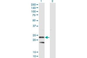 Western Blot analysis of SSR2 expression in transfected 293T cell line by SSR2 monoclonal antibody (M01), clone 4C1. (SSR2 抗体  (AA 51-150))