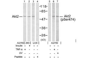 Image no. 2 for anti-V-Akt Murine Thymoma Viral Oncogene Homolog 2 (AKT2) (pSer474) antibody (ABIN196826) (AKT2 抗体  (pSer474))