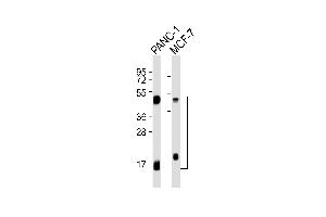 All lanes : Anti-Cathepsin D LC Antibody at 1:1000 dilution Lane 1: NC-1 whole cell lysates Lane 2: MCF-7 whole cell lysates Lysates/proteins at 20 μg per lane. (Cathepsin D 抗体  (Light Chain))