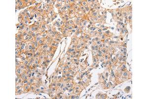 Immunohistochemistry (IHC) image for anti-ATP-Binding Cassette, Sub-Family C (CFTR/MRP), Member 1 (ABCC1) antibody (ABIN3017211) (ABCC1 抗体)