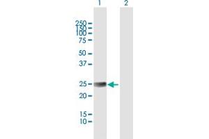 Western Blot analysis of ETHE1 expression in transfected 293T cell line by ETHE1 MaxPab polyclonal antibody. (ETHE1 抗体  (AA 1-254))