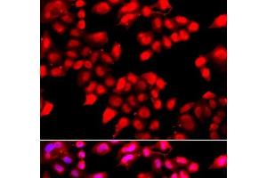 Immunofluorescence analysis of A549 cells using KU70 Polyclonal Antibody (XRCC6 抗体)