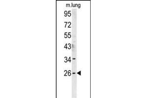 DNJC8 Antibody (C-term) (ABIN651765 and ABIN2840393) western blot analysis in mouse lung tissue lysates (15 μg/lane). (DNAJC8 抗体  (C-Term))