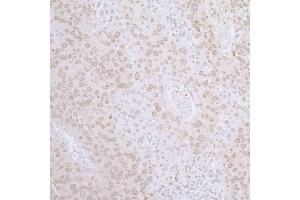 Immunohistochemistry (IHC) image for anti-LAP2 beta gamma/tmpo (AA 350-400) antibody (ABIN7455057) (LAP2 beta gamma/tmpo (AA 350-400) 抗体)