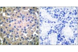 Immunohistochemistry (IHC) image for anti-Transglutaminase 2 (C Polypeptide, Protein-Glutamine-gamma-Glutamyltransferase) (TGM2) (AA 1-50) antibody (ABIN1533422)