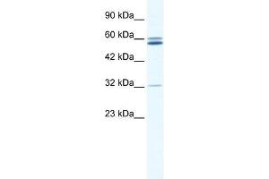Western Blot showing ZNF491 antibody used at a concentration of 1-2 ug/ml to detect its target protein. (ZNF491 抗体  (N-Term))