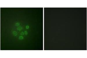Immunofluorescence analysis of A549 cells, using MDM2 (Phospho-Ser166) Antibody. (MDM2 抗体  (pSer166))