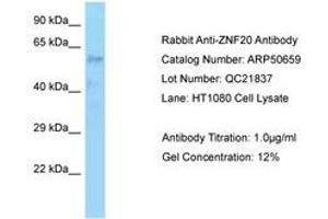 Image no. 1 for anti-Zinc Finger Protein 20 (ZNF20) (AA 449-498) antibody (ABIN6749920) (ZNF20 抗体  (AA 449-498))