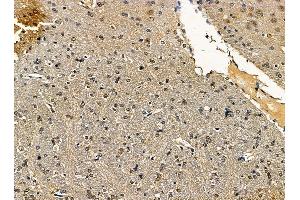 ABIN7095423 and ABIN7099480 at 1/100 staining rat brain tissue by IHC-P. (SCAI 抗体)
