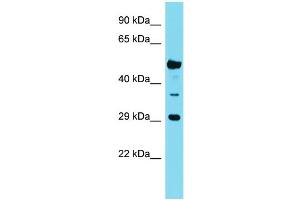 Host: Rabbit Target Name: OR6Q1 Sample Type: Fetal Kidney lysates Antibody Dilution: 1. (OR6Q1 抗体  (C-Term))