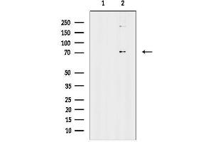 anti-Amyotrophic Lateral Sclerosis 2 (Juvenile) Chromosome Region, Candidate 11 (ALS2CR11) (Internal Region) antibody