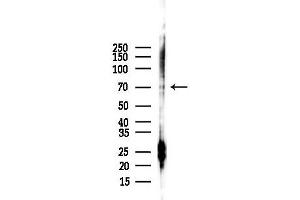 Western blot analysis of lysates from Mouse liver, using p70 S6 Kinase Antibody at 1/1000 dilution.