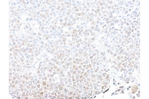 Immunohistochemistry (IHC) image for anti-SWI/SNF Related, Matrix Associated, Actin Dependent Regulator of Chromatin, Subfamily B, Member 1 (SMARCB1) (AA 225-275) antibody (ABIN7795716)