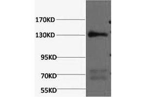 Western Blotting (WB) image for anti-Nitric Oxide Synthase 3 (Endothelial Cell) (NOS3) antibody (ABIN5961404) (ENOS 抗体)