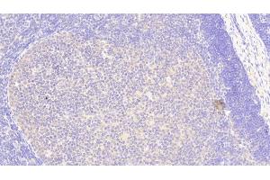 Immunohistochemistry (IHC) image for anti-Dipeptidyl-Peptidase 3 (DPP3) (AA 2-261) antibody (ABIN7445195)