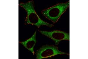 Fluorescent image of Hela cell stained with PI3KCD Antibody (C-term) (ABIN392563 and ABIN2842106). (PIK3CD 抗体  (C-Term))