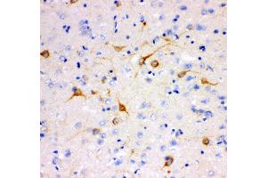 Anti- IP3 receptor antibody,IHC(P) IHC(P): Rat Brain Tissue