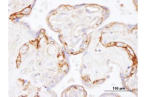 Immunohistochemistry (IHC) image for anti-Epidermal Growth Factor Receptor (EGFR) (AA 1100-1150) antibody (ABIN7454623)