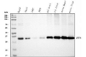 Western blot analysis of ETFA using anti-ETFA antibody (ABIN7599281).