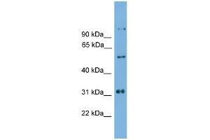 WB Suggested Anti-Irx2 Antibody Titration: 0. (IRX2 抗体  (C-Term))