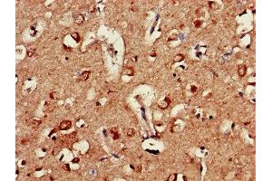Immunohistochemistry of paraffin-embedded human brain tissue using ABIN7144364 at dilution of 1:100 (AP2M1 抗体  (AA 1-435))