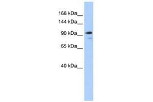 Image no. 1 for anti-Angiomotin Like 1 (AMOTL1) (AA 144-193) antibody (ABIN6740787)