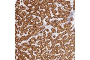 Immunohistochemical staining of human liver with SLC38A9 polyclonal antibody  shows strong cytoplasmic positivity in hepatocytes. (SLC38A9 抗体)