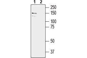 EPH Receptor A6 抗体  (Extracellular, N-Term)