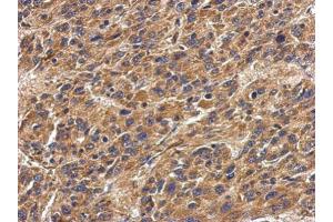 Immunohistochemistry (IHC) image for anti-Major Histocompatibility Complex, Class II, DP alpha 1 (HLA-DPA1) antibody (ABIN2855822)