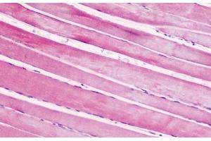 Human, Skeletal muscle: Formalin-Fixed Paraffin-Embedded (FFPE) (CRHR2 抗体  (AA 71-120))