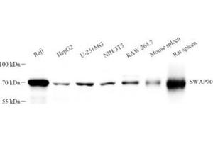 Western blot analysis of SWAP70 (ABIN7075775) at dilution of 1: 2000 (SWAP70 抗体)