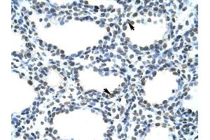 SFRS10 antibody was used for immunohistochemistry at a concentration of 4-8 ug/ml to stain Alveolar cells (arrows) in Human Lung. (TRA2B 抗体)