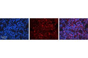 Immunohistochemistry (IHC) image for anti-Cyclin D3 (CCND3) (C-Term) antibody (ABIN2792167)