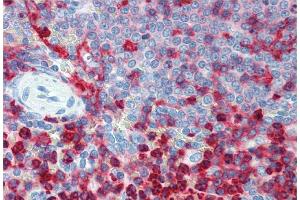 Immunohistochemistry staining of human spleen (paraffin sections) using anti-CD18 (MEM-48). (Integrin beta 2 抗体)