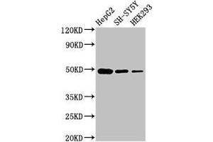 Western Blot Positive WB detected in: HepG2 whole cell lysate, SH-SY5Y whole cell lysate, HEK293 whole cell lysate All lanes: FDFT1 antibody at 3 μg/mL Secondary Goat polyclonal to rabbit IgG at 1/50000 dilution Predicted band size: 49, 41, 39, 36, 44 kDa Observed band size: 49 kDa (FDFT1 抗体  (AA 2-417))
