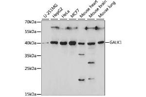 Western blot analysis of extracts of various cell lines, using GALK1 antibody. (GALK1 抗体)