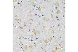 Immunohistochemistry of paraffin-embedded rat brain using CAMK1D Antibody (ABIN5975586) at dilution of 1/100 (40x lens). (CAMK1D 抗体)