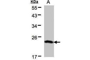 WB Image Sample(30 μg of whole cell lysate) A:H1299 12% SDS PAGE antibody diluted at 1:500 (BTF3 抗体)